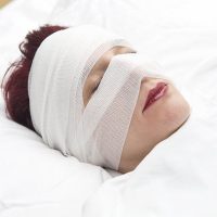 Injury_Head Injury_Head